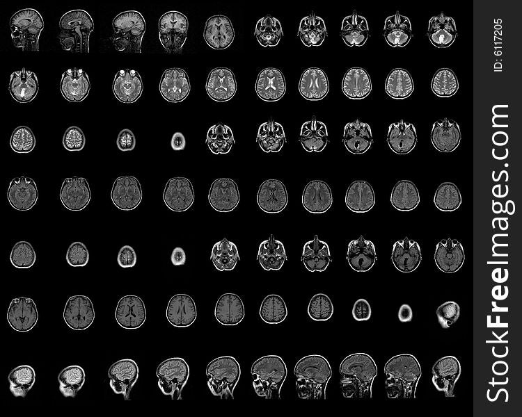Brain and head MRI. medical photo