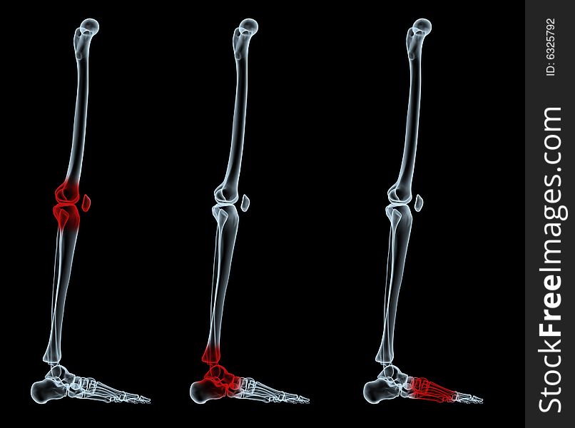 3d rendered scene with painful areas. 3d rendered scene with painful areas