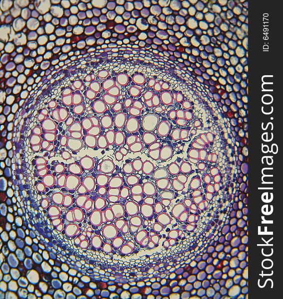 Gleichenia (Staghorn) fern-microscopic view of a cross section of rhizome 100X. Gleichenia (Staghorn) fern-microscopic view of a cross section of rhizome 100X