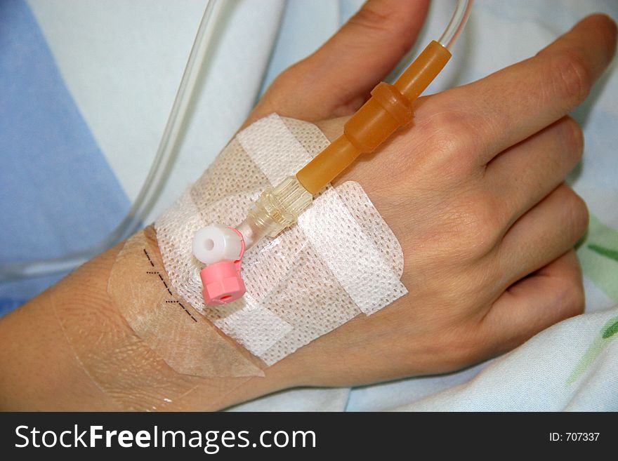 Hand With Perfusion