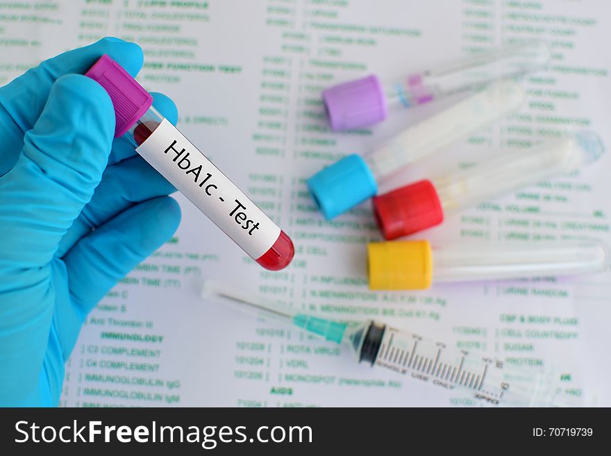 Blood sample for hemoglobin A1c test, diabetes diagnosis. Blood sample for hemoglobin A1c test, diabetes diagnosis