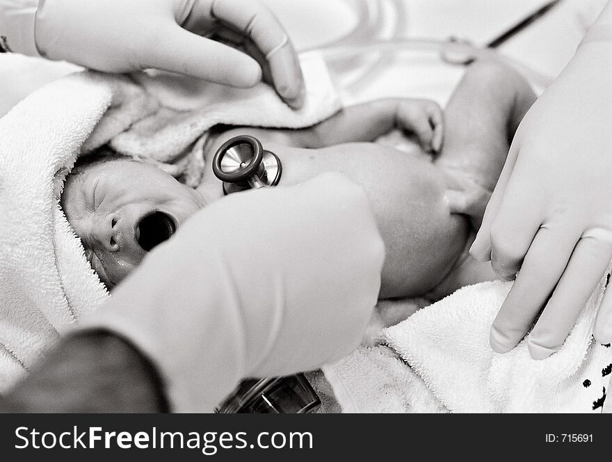 Newborn Baby being checked minutes after birth by Paediatrician. Film grain visible.