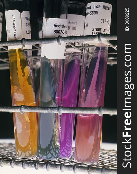 test tubes with actual samples used in medical laboratories. test tubes with actual samples used in medical laboratories