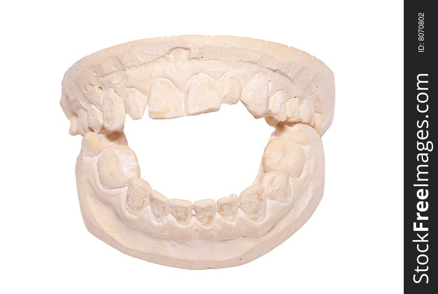 This is a cast made from teeth that a dentist use