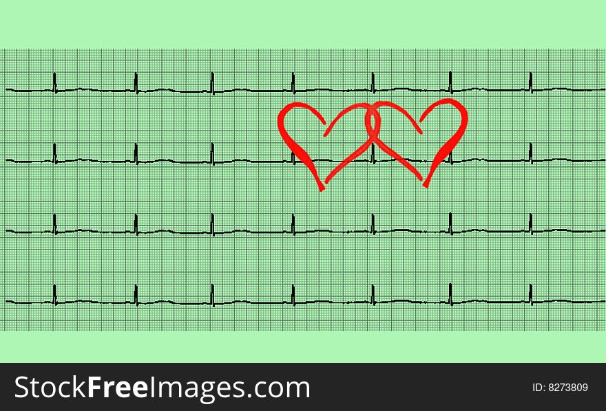 Love hearts in a cardiogram illustration. Love hearts in a cardiogram illustration.
