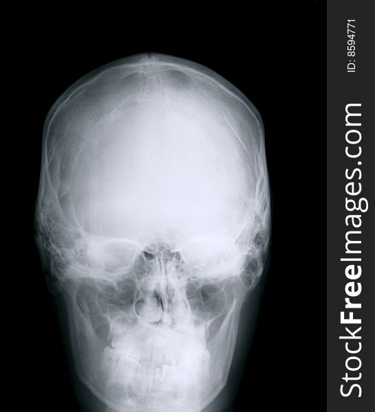 X-ray of a human skull, Negative film. X-ray of a human skull, Negative film