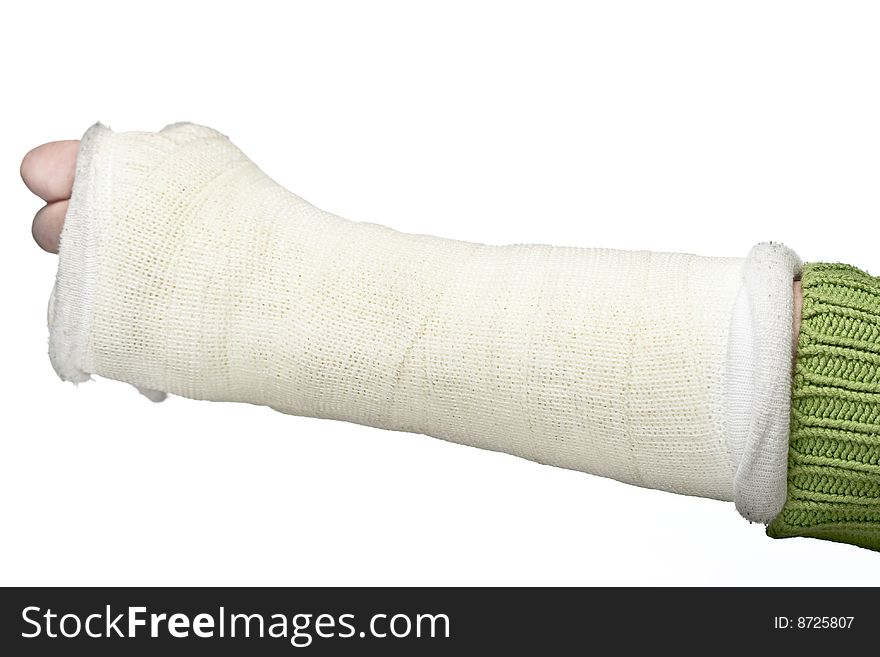 A close up of a broken arm in a plaster cast on a white background.