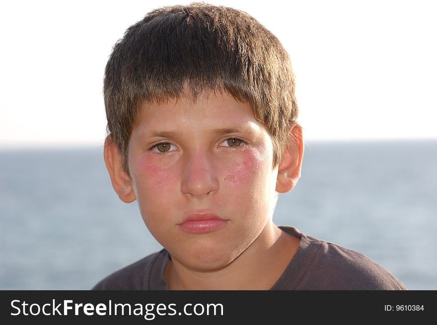 Portrait of a child burned by the sun. Portrait of a child burned by the sun