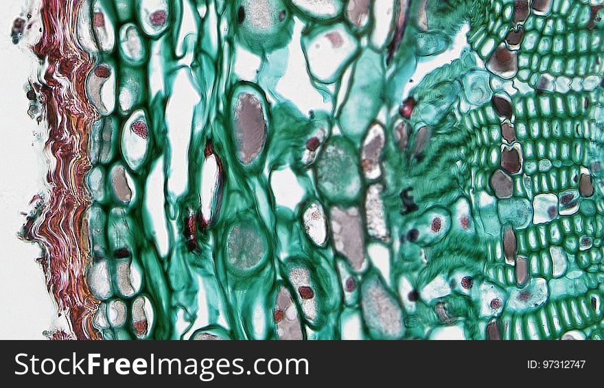 cross section: Pinus stem magnification: 400x During the first year of growth the cutinized epidermis is replaced by protective growth of cork rich periderm. The outer periderm consists of layers of cork cells, the phellem, which produces waterproofing suberin. Cork cells are dead at maturity. Deep to the phellem is a living layer of cork cambium or phellogen and beneath that, layers of cork parenchyma or phelloderm. Many cells in the periderm contain dark staining tannins. The cortex is divided into a thin outer hypodermis of lignified sclerenchyma cells and thicker inner cortex of thin walled parenchyma cells containing chloroplasts. Large resin ducts are surrounded by secretory parenchyma that produces resins and turpentines. Some cells enlarge into dark staining tyloses. Both endoderm and pericycle are inconspicuous. cross section: Pinus stem magnification: 400x During the first year of growth the cutinized epidermis is replaced by protective growth of cork rich periderm. The outer periderm consists of layers of cork cells, the phellem, which produces waterproofing suberin. Cork cells are dead at maturity. Deep to the phellem is a living layer of cork cambium or phellogen and beneath that, layers of cork parenchyma or phelloderm. Many cells in the periderm contain dark staining tannins. The cortex is divided into a thin outer hypodermis of lignified sclerenchyma cells and thicker inner cortex of thin walled parenchyma cells containing chloroplasts. Large resin ducts are surrounded by secretory parenchyma that produces resins and turpentines. Some cells enlarge into dark staining tyloses. Both endoderm and pericycle are inconspicuous.