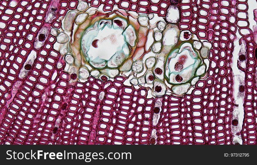 cross section: Pinus stem magnification: 100x Because of the greater production of xylem, the vascular cylinder is dominated by radially arranged rays of secondary xylem interspaced with medullary rays of parenchyma cells. Conspicuous resin ducts are present throughout the xylem. cross section: Pinus stem magnification: 100x Because of the greater production of xylem, the vascular cylinder is dominated by radially arranged rays of secondary xylem interspaced with medullary rays of parenchyma cells. Conspicuous resin ducts are present throughout the xylem.