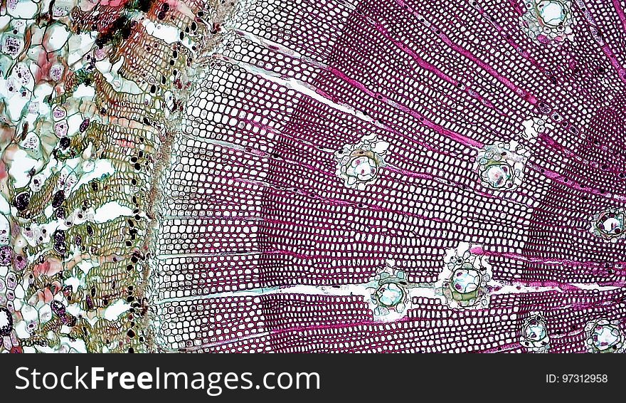 Gymnosperm Stem: Annual Rings in Three Year Pinus