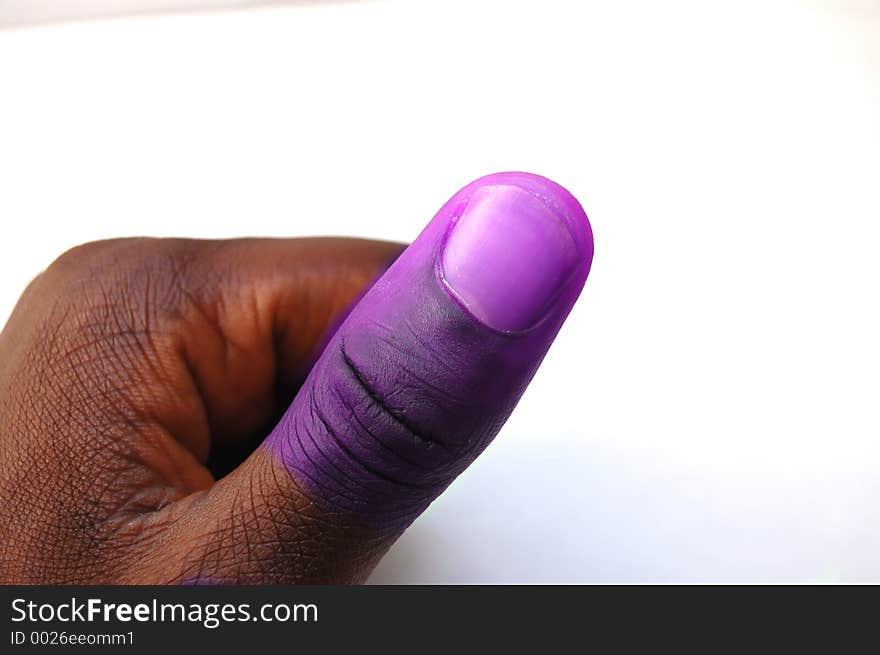 This is an image of a thumb coloured in purple, metaphor for sore thumb. This is an image of a thumb coloured in purple, metaphor for sore thumb.