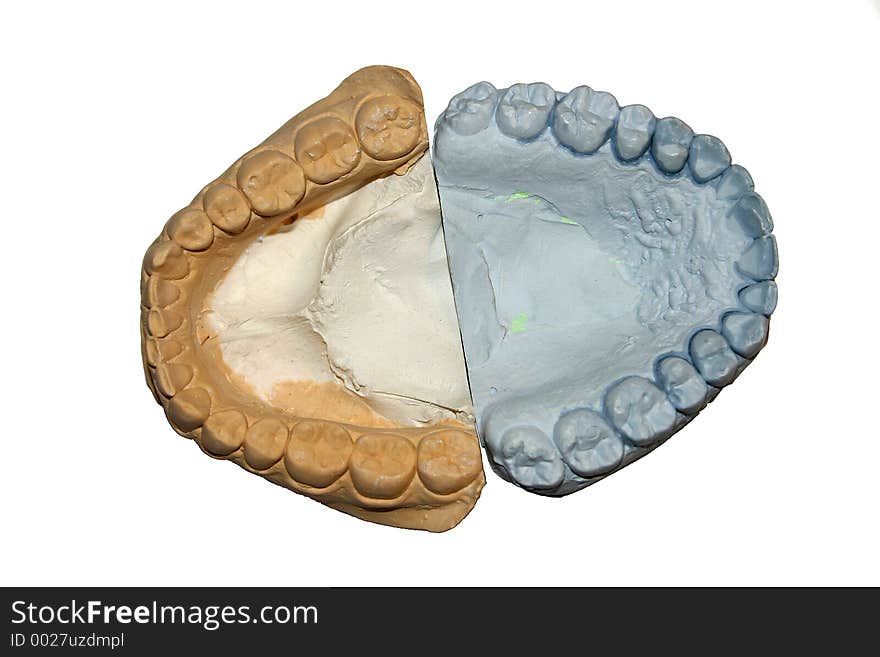 Cast teeth model