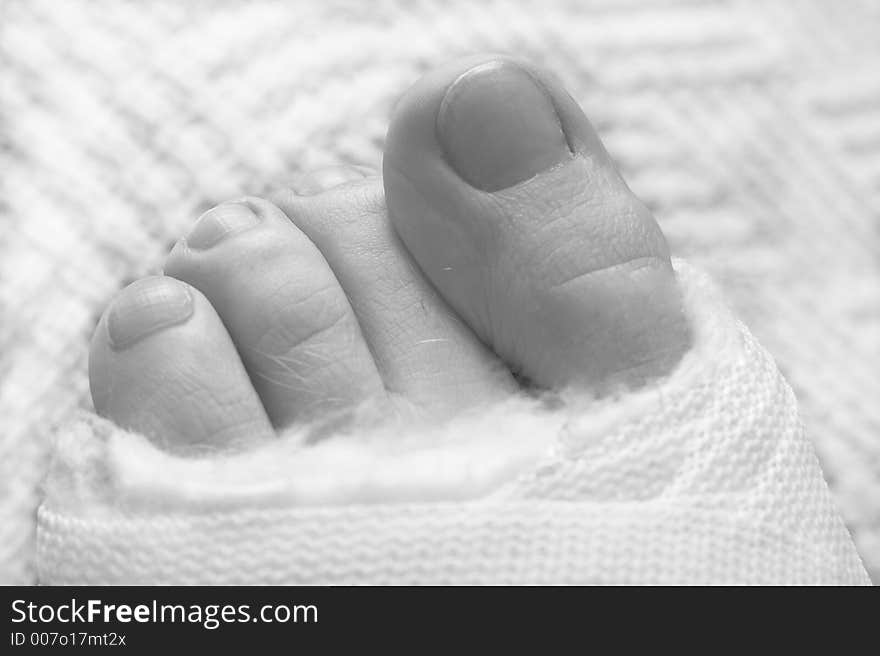 Four toes sticking out of the cast. Black and white. Shallow Depth of Field. Four toes sticking out of the cast. Black and white. Shallow Depth of Field.