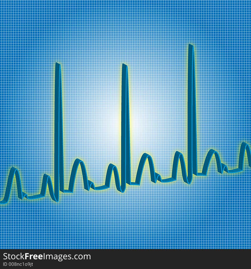 Heart beat line read out. Heart beat line read out