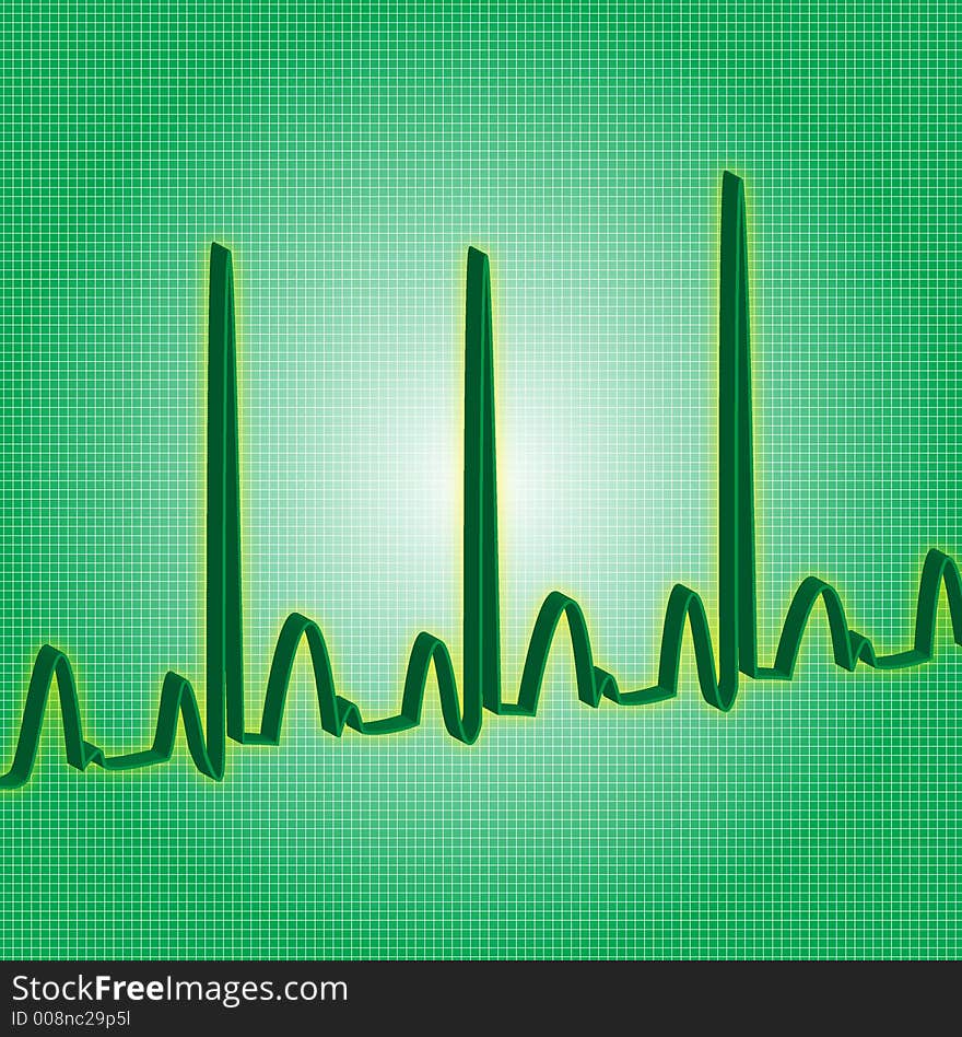 Heart beat line read out green. Heart beat line read out green