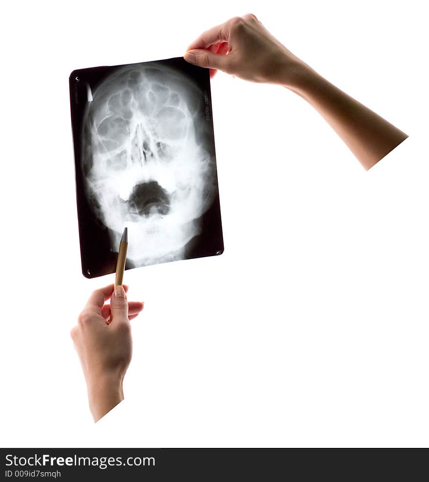 X-ray Shot