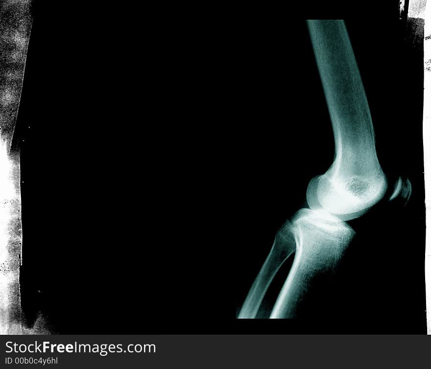 X-ray Arm