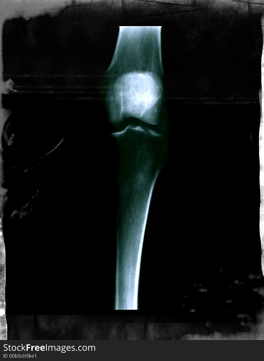 X-Ray Leg