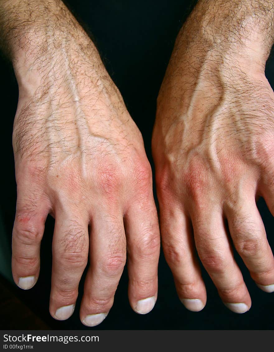 Close up of hands on the black background. Close up of hands on the black background