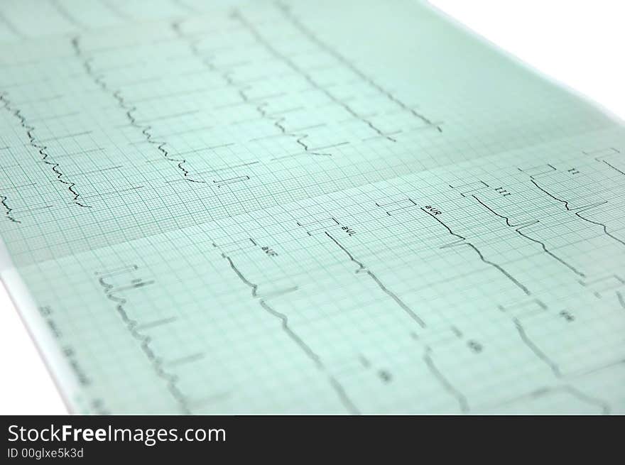 Electrocardiogram