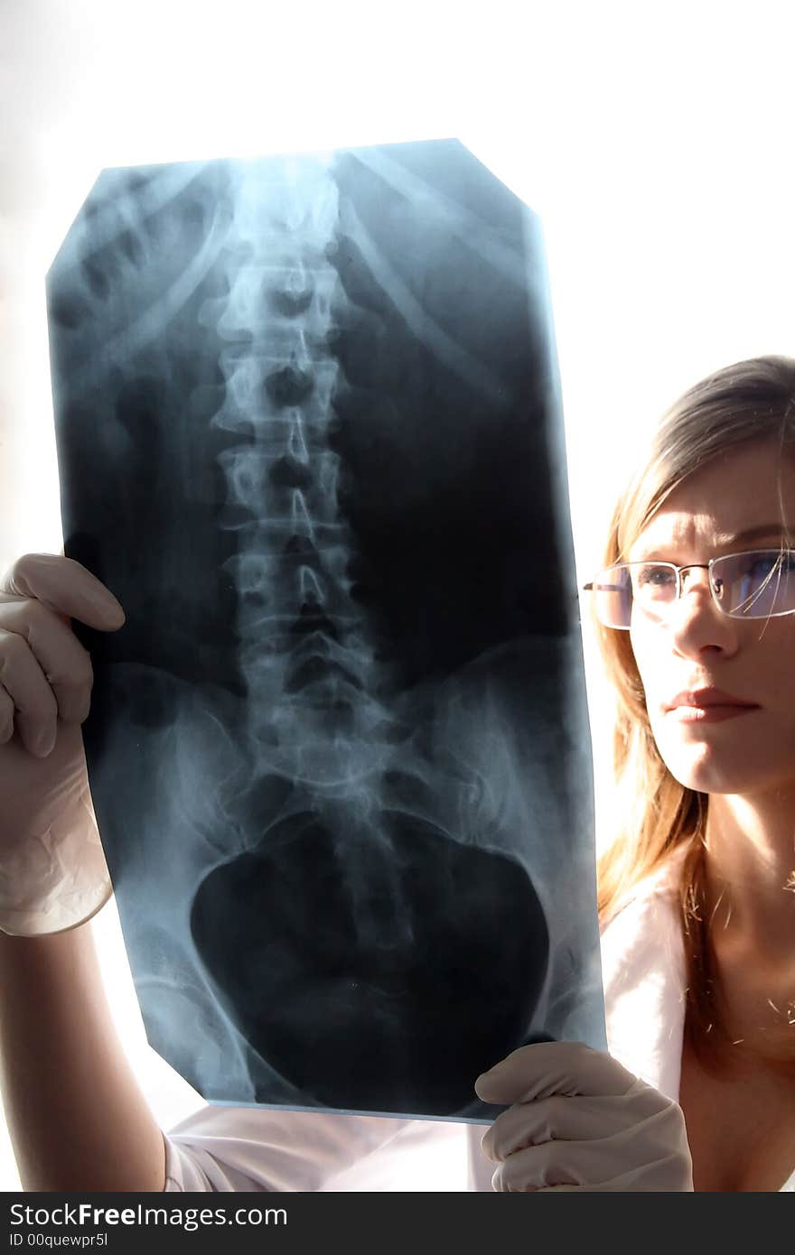 The young beautiful girl in glasses looks at a medical picture. The young beautiful girl in glasses looks at a medical picture