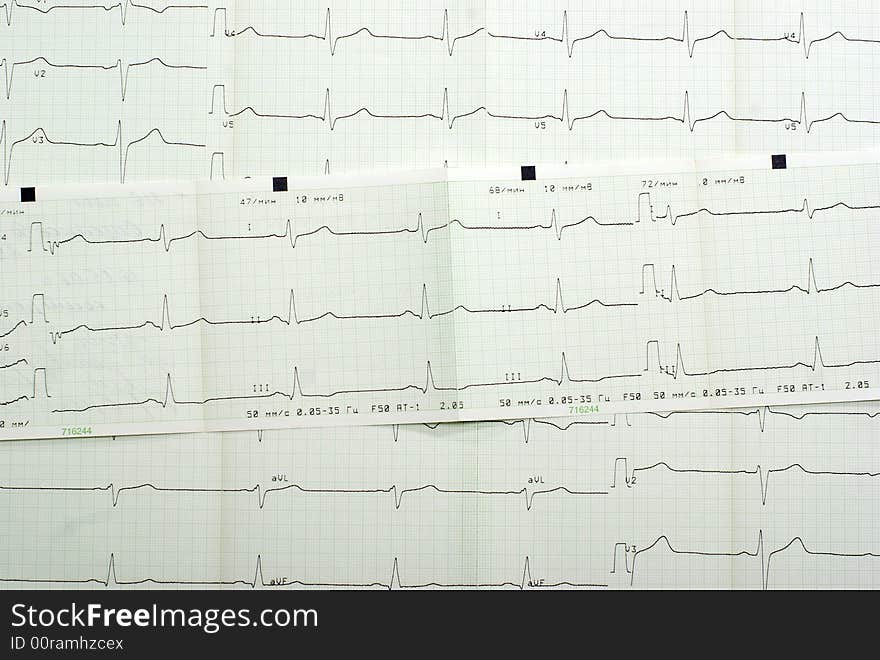 Cardiogram background