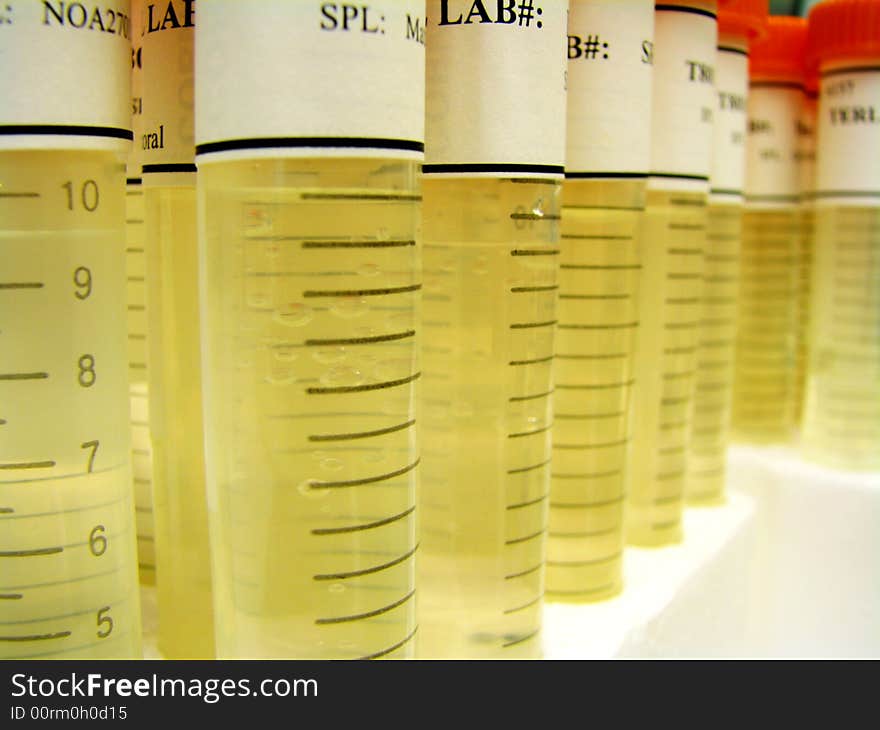 These vials are filled with various tissue samples which have been dissolved with acids. These vials are filled with various tissue samples which have been dissolved with acids.