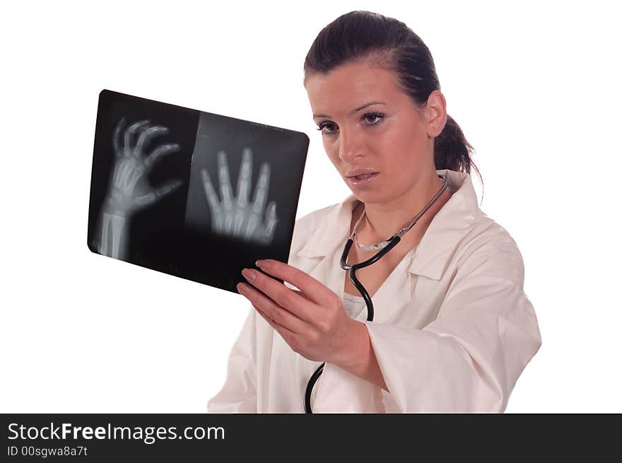 Doctor female holding x ray of hand