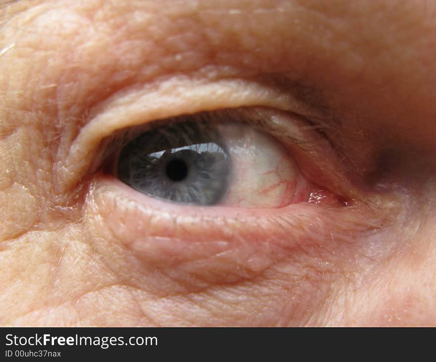 Senior Males Eye