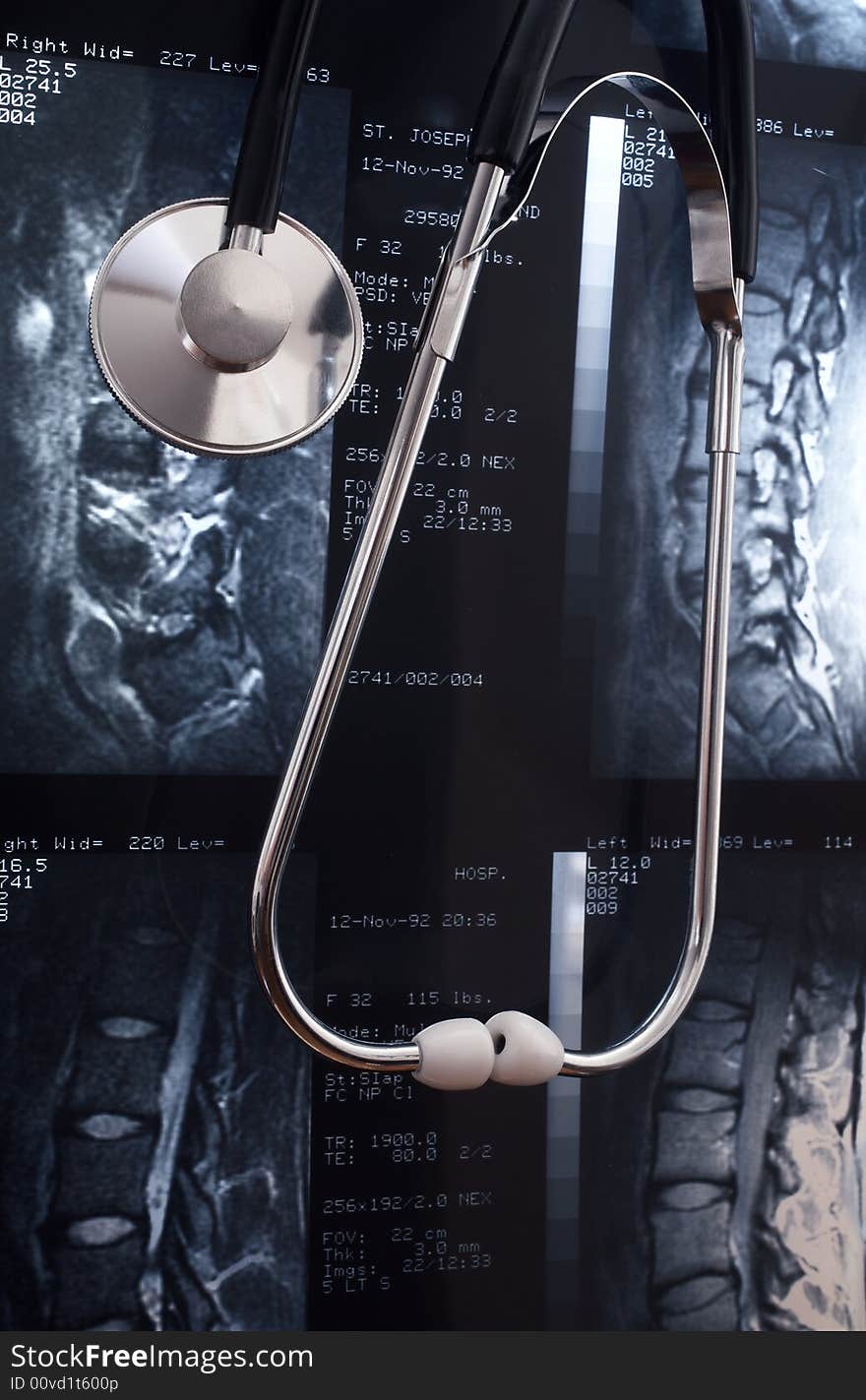 Stethoscope leaning against MRI of lumbar disc all info is anonymous. Stethoscope leaning against MRI of lumbar disc all info is anonymous