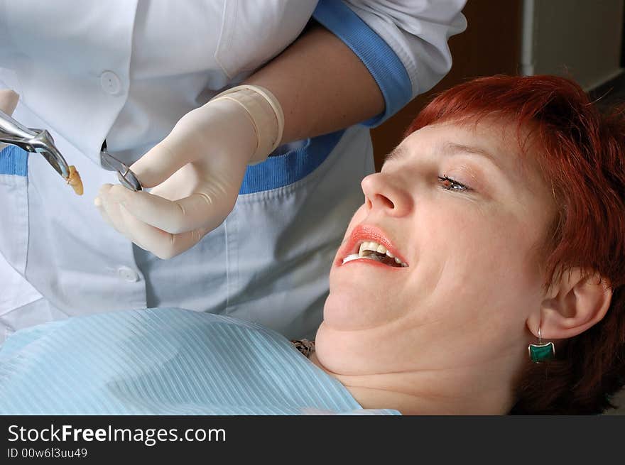 Woman with open mouth look on her extract tooth. in dental clinic