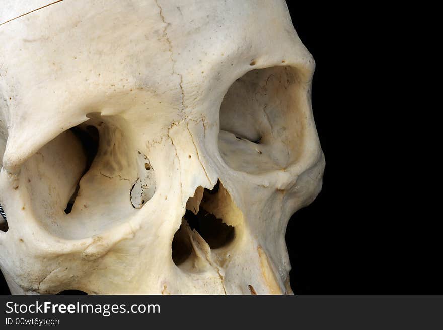 Human Skull Eye Sockets