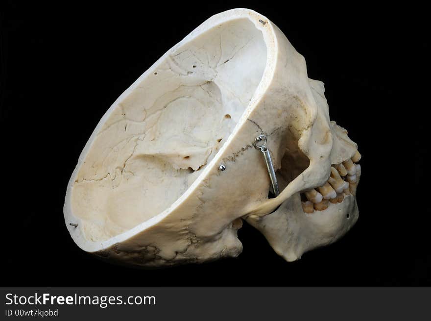 A real human skull with the cap cut away to show the interior of the brain case. A real human skull with the cap cut away to show the interior of the brain case.