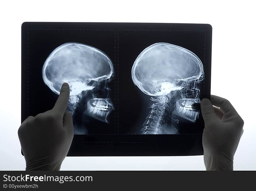 X-rays of human head. X-rays of human head