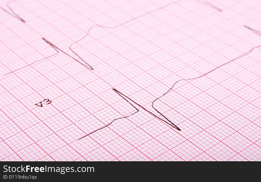 Close-up of ecg graph as background