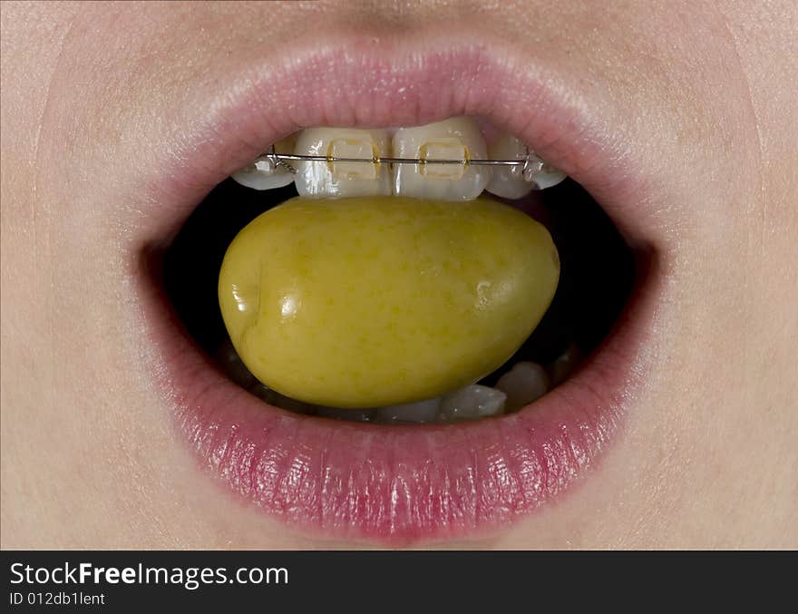 A green olive about to be eaten for a woman with braces. A green olive about to be eaten for a woman with braces.