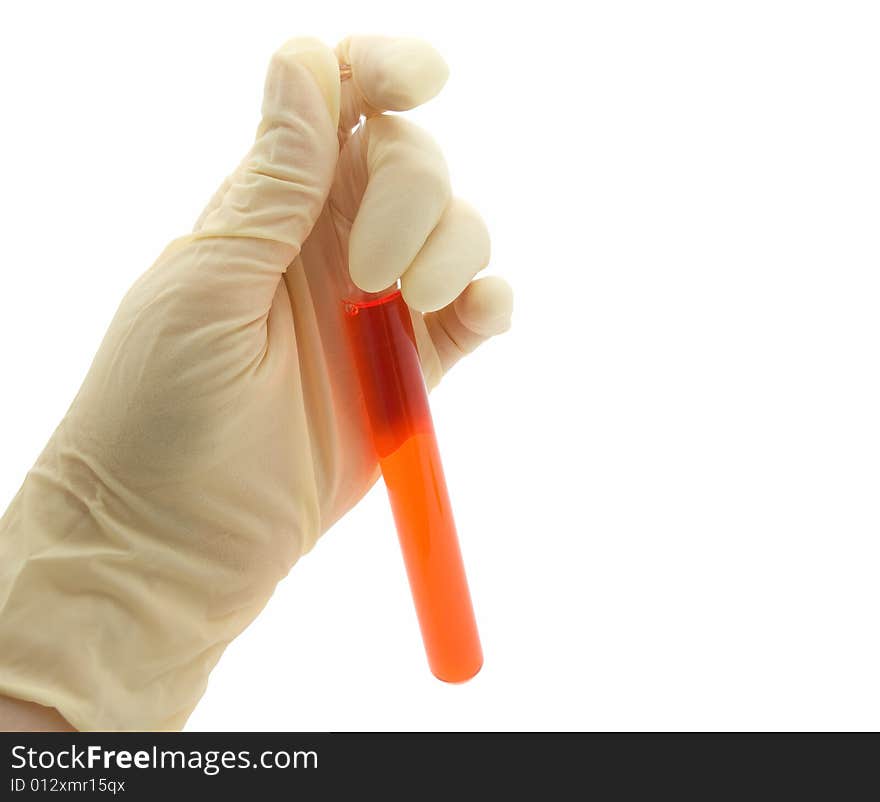 Hand holding blood in test tube.