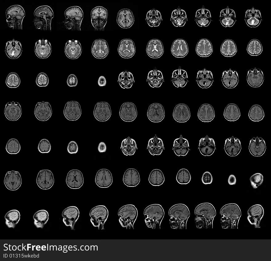 Brain and head MRI. medical photo