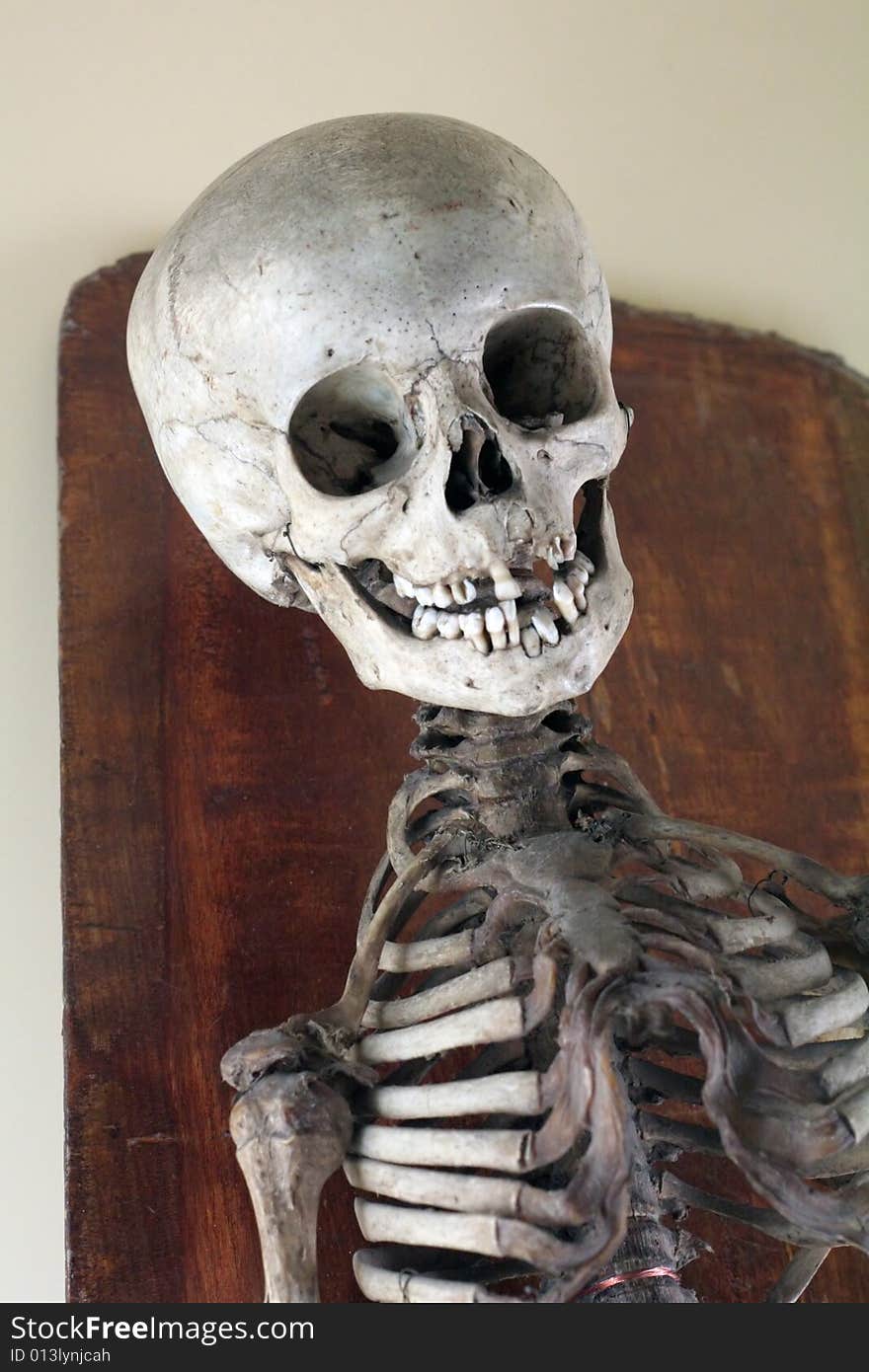 Antique Medical Skeleton