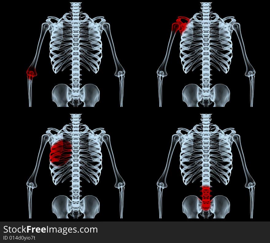 3d rendered scene with painful areas. 3d rendered scene with painful areas