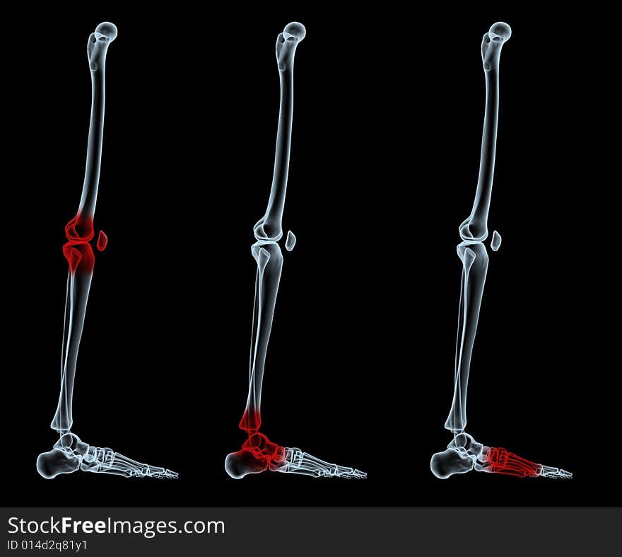 3d rendered scene with painful areas. 3d rendered scene with painful areas