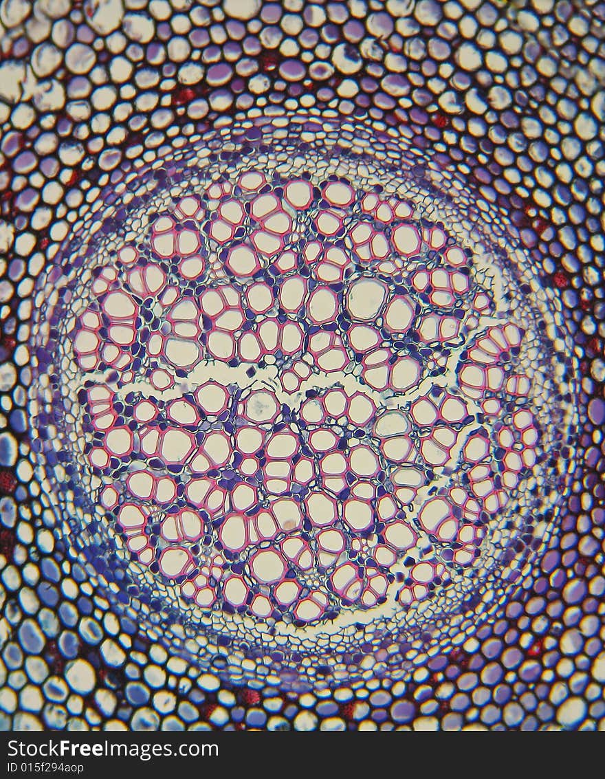 Gleichenia (Staghorn) fern-microscopic view of a cross section of rhizome 100X. Gleichenia (Staghorn) fern-microscopic view of a cross section of rhizome 100X