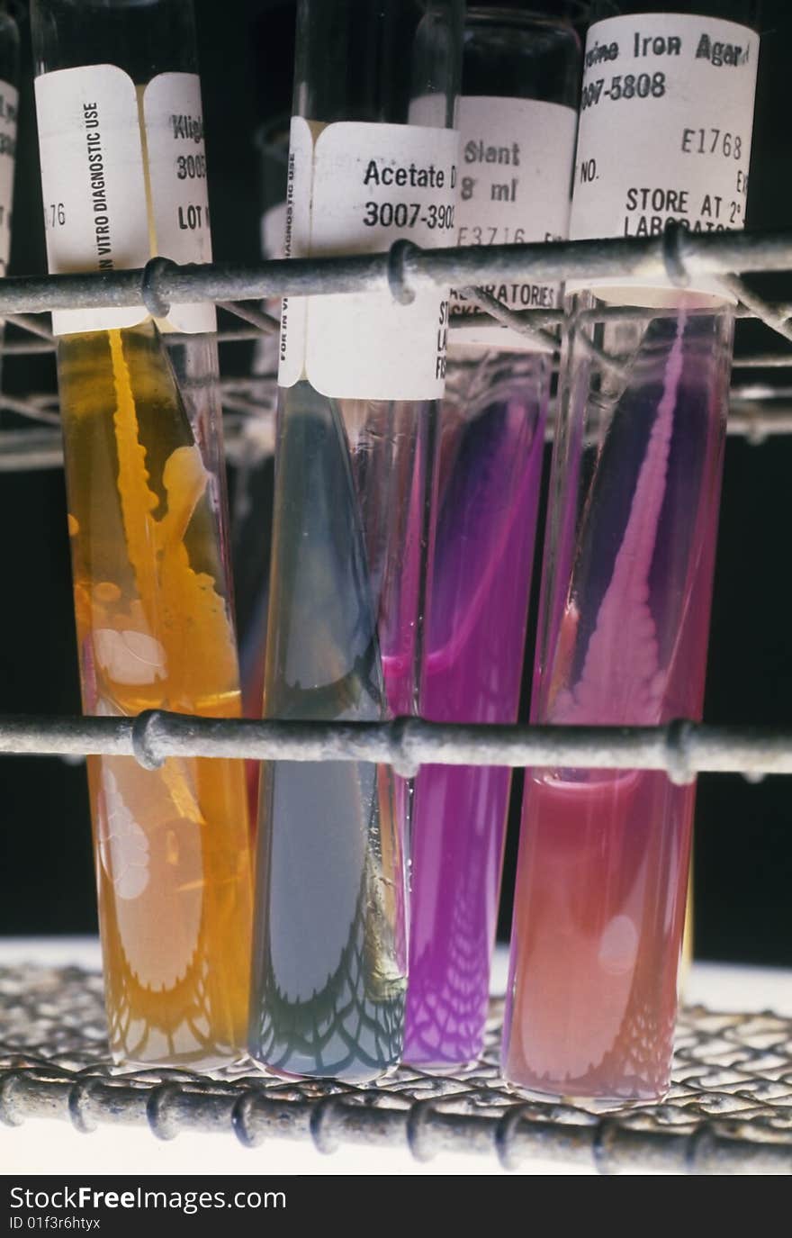 test tubes with actual samples used in medical laboratories. test tubes with actual samples used in medical laboratories