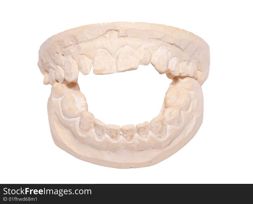 This is a cast made from teeth that a dentist use