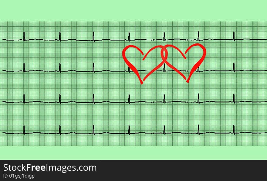 Love hearts in a cardiogram illustration. Love hearts in a cardiogram illustration.