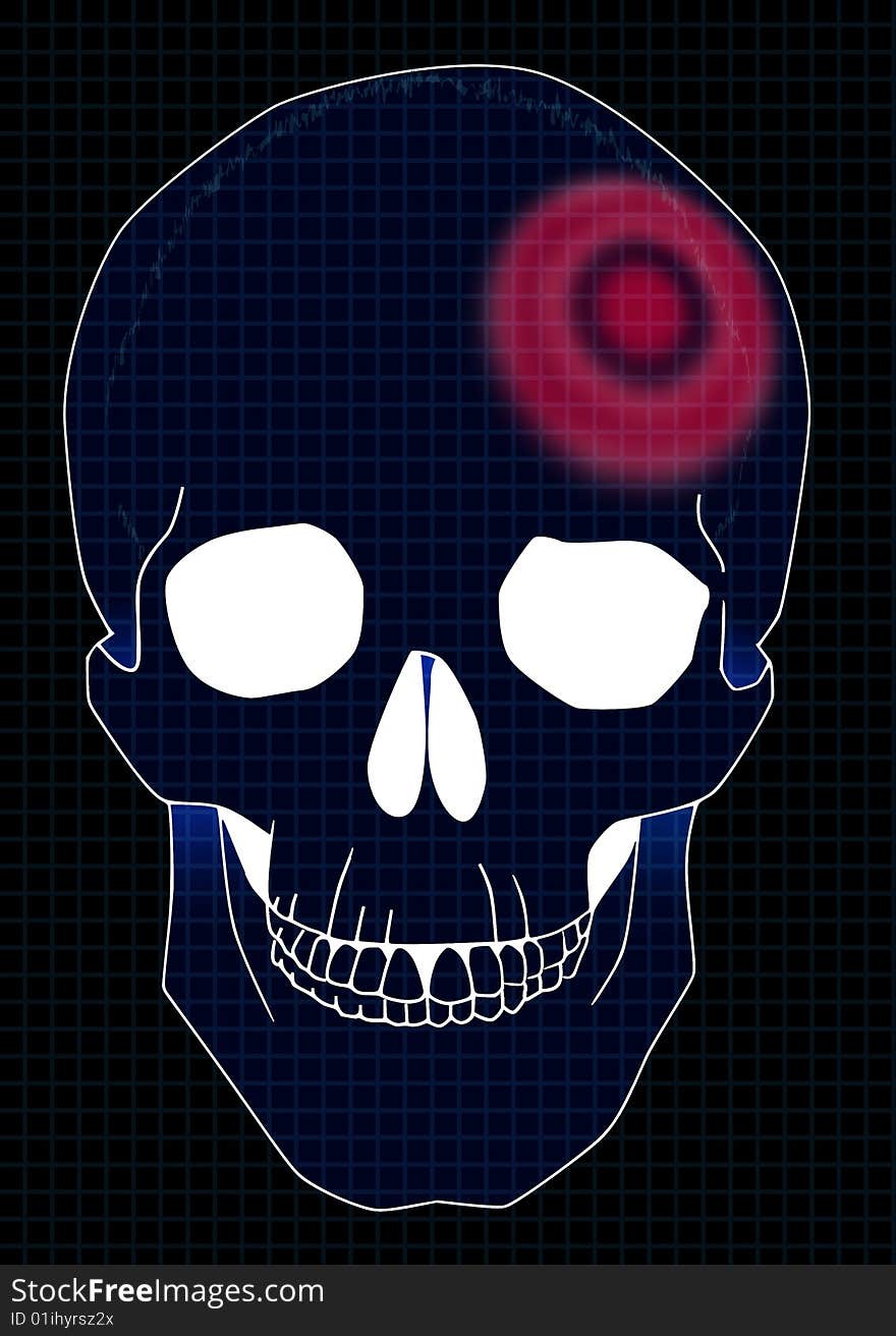 Head trauma illustration. Medical study.