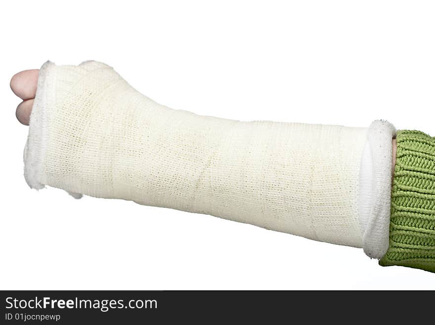 A close up of a broken arm in a plaster cast on a white background.