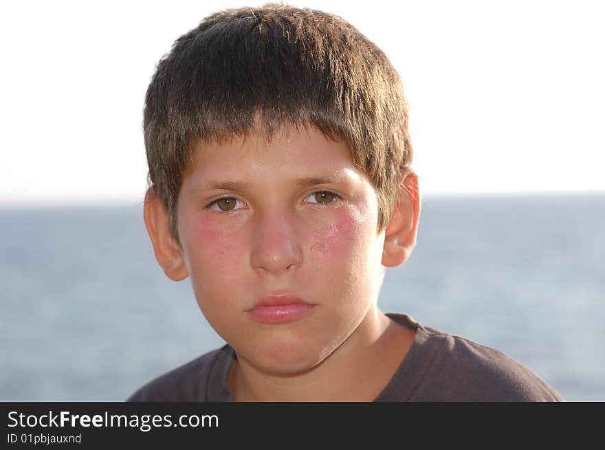 Portrait of a child burned by the sun. Portrait of a child burned by the sun