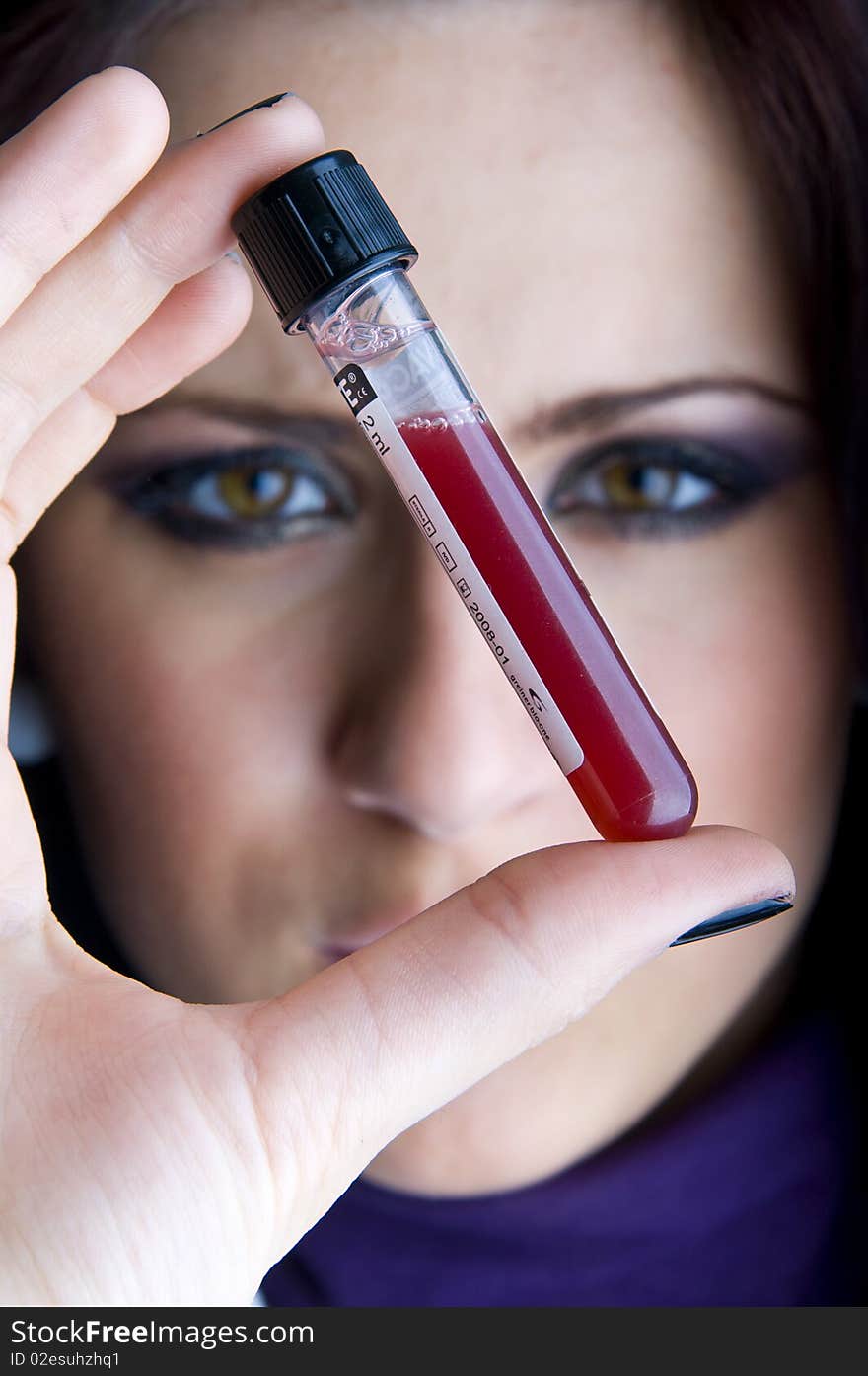 Doctor holding a tube with blood sample